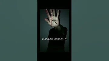 Shorts ابيوسف لا مش علي ما يرام راب 