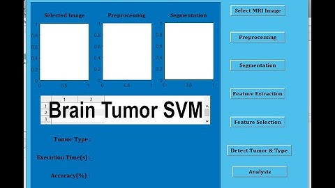 Brain Tumor Detection Using Matlab (SVM)