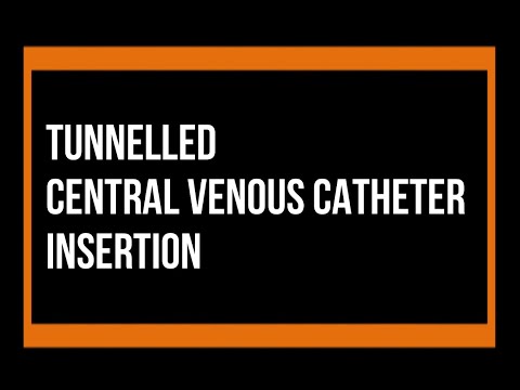 Tunneled Central Venous Catheter Insertion : A Step by Step