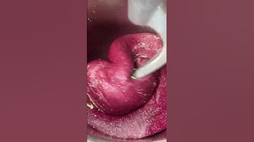 Adding Silly String to Slime!