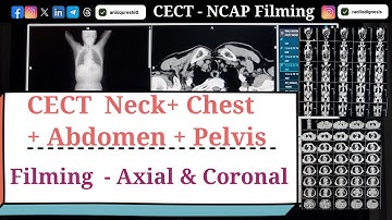 Cect NCAP Filming | Phases , Sections and Layout | By Anis Qureshi