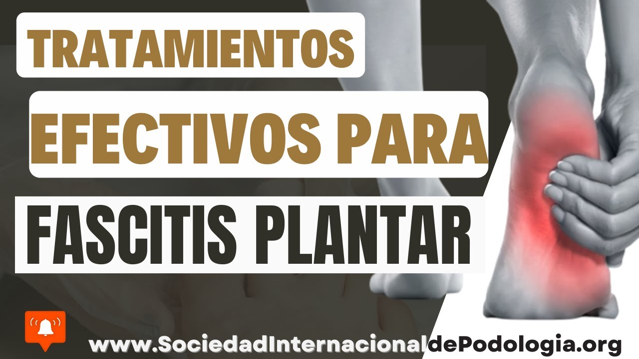 FASCITIS PLANTAR: TRATAMIENTO - CLÍNICA NAVARRO PODOLOGÍA