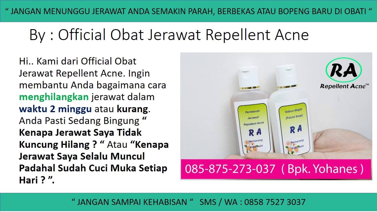 Cara Menghilangkan Jerawat Nasi Di Dahi, Cara
