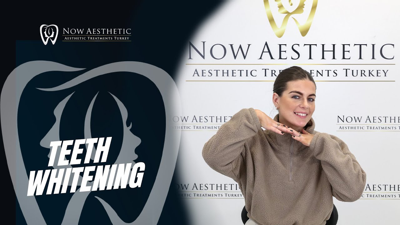 The treatment that transforms your smile in just one hour: Teeth Whitening