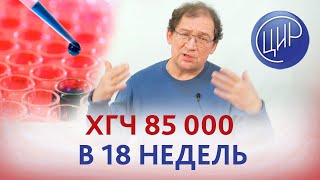 Огромный ХГЧ при беременности. ХГЧ 85000 в 18 недель беременности. Отвечает Гузов И.И.