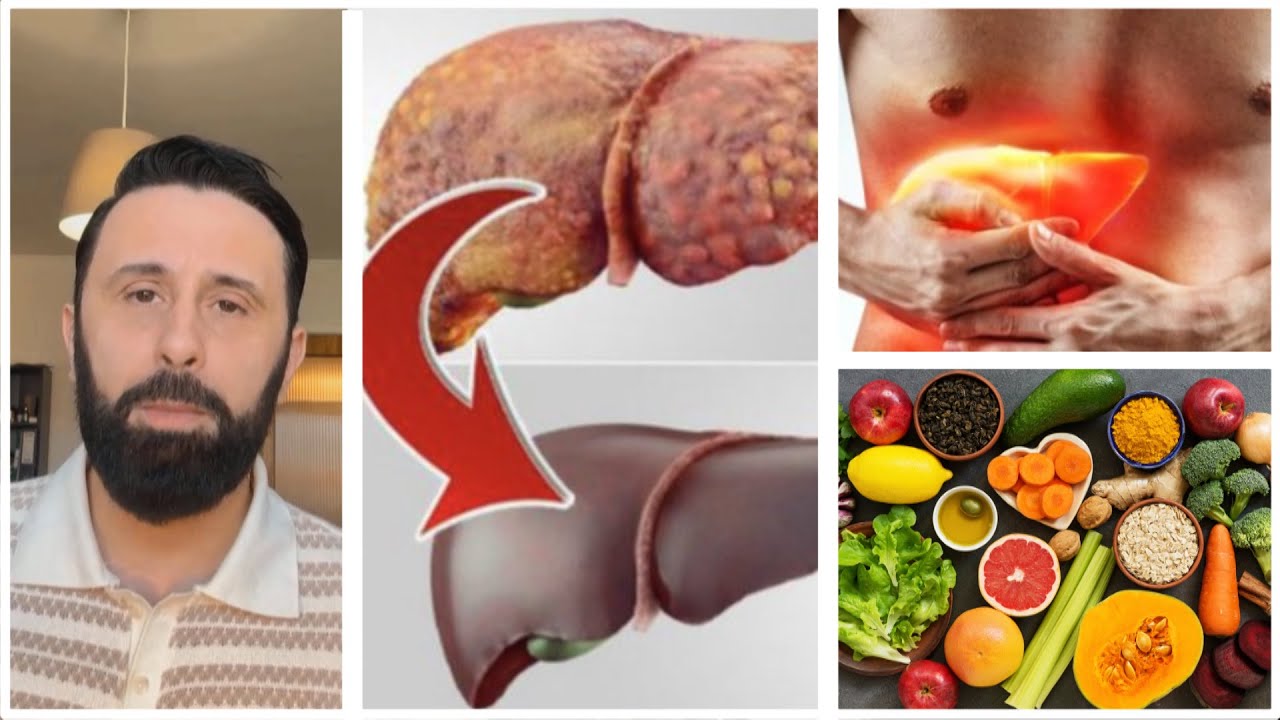 4 hapa për pastrimin e mëlçisë së dhjamosur nga Altin Joka/ Si të kuptoni problemet me mëlçinë…