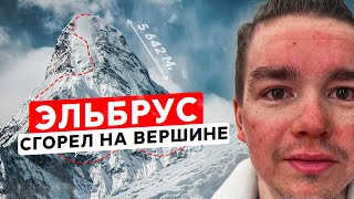 видео: Восхождение на Эльбрус 2024 / ОЧЕНЬ ЖЕСТКО СГОРЕЛ картинка: Восхождение на Эльбрус 2024 / ОЧЕНЬ ЖЕСТКО СГОРЕЛ