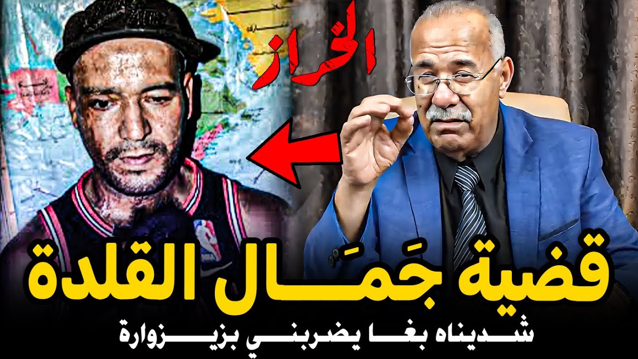 عبد القادر الخراز: قضية جَمـَـــال القَلدة Abdelkader kharraz