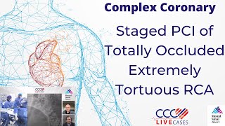 Staged PCI of Totally Occluded Extremely Tortuous RCA