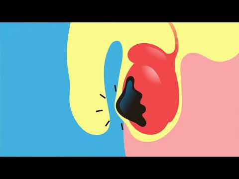 Video: Come superare il blocco del cerume dell'orecchio (con immagini)