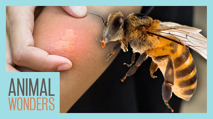 What You Need To Know About Bee Stings