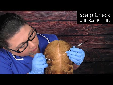 ASMR Scalp Check with Bad Results (Tweezers, Scalp Treatment, Scalp Massage) Medical Roleplay