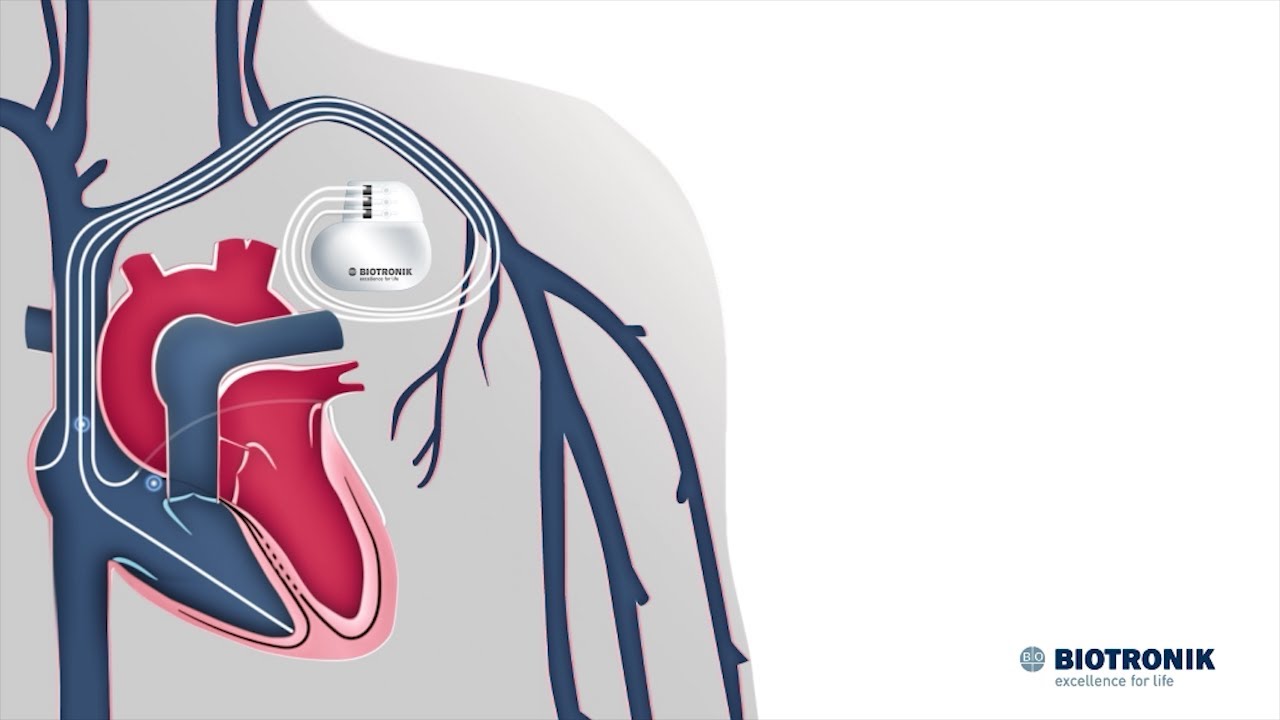 Overview – Cardiac Pathology | Lecturio