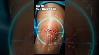 10 Warning Signs of Poor Blood Circulation in Your Legs
