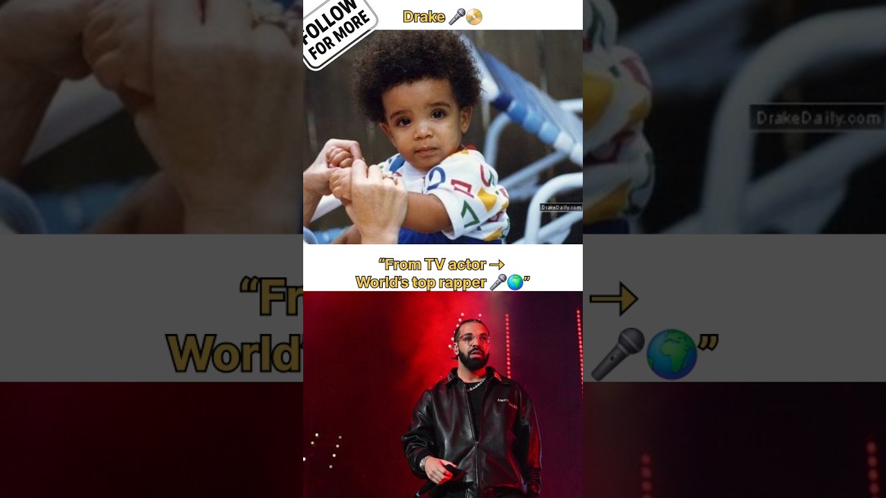 Drake 🎤 💸 transformation 