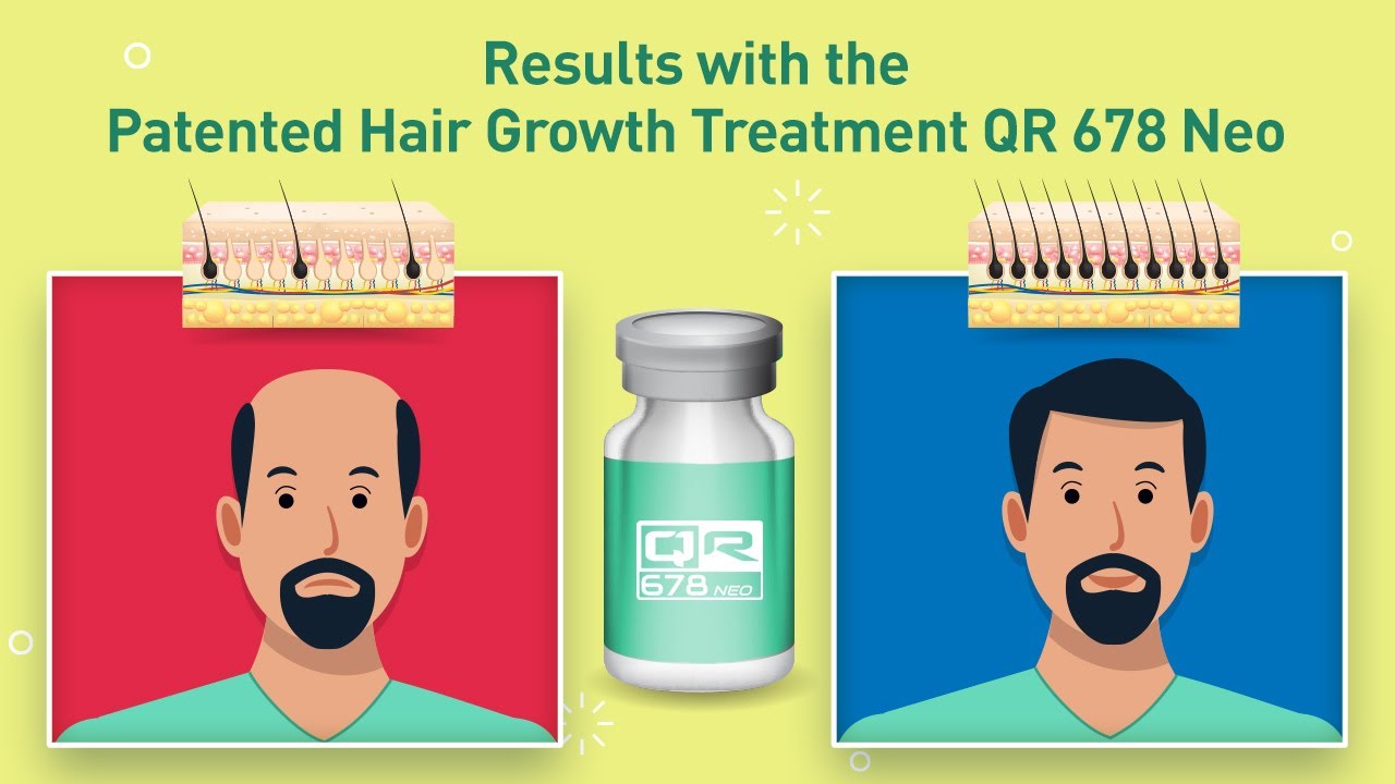 QR 678 - Best Hair Loss Treatment for Men & Women in Mumbai, India - YouTube