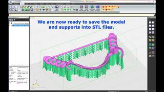 Denture framework support generation video.