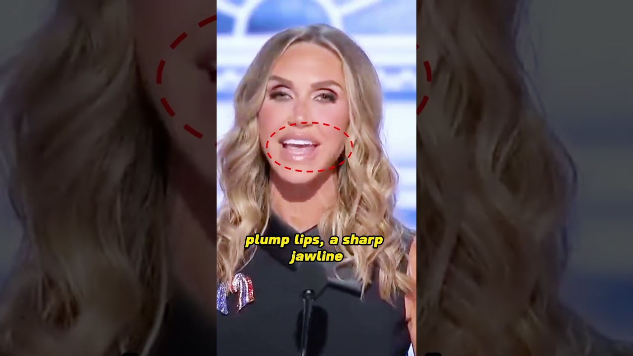 Why all the billionaires' wives nearly all have similar plastic faces?