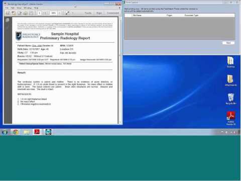 MEA FastAttach DSG Demo