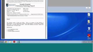 MEA FastAttach DSG Demo