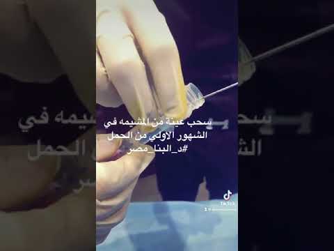 فيديو: ما هو مقدار عينة الزغابات المشيمية؟