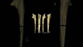 At least 470,000 years old, the wooden Kalambo structure