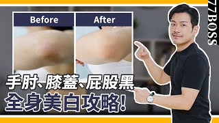 手肘膝蓋髒兮兮、屁股黑沒救了？！超級美白攻略，２８天白到你發亮～～！【77老大】