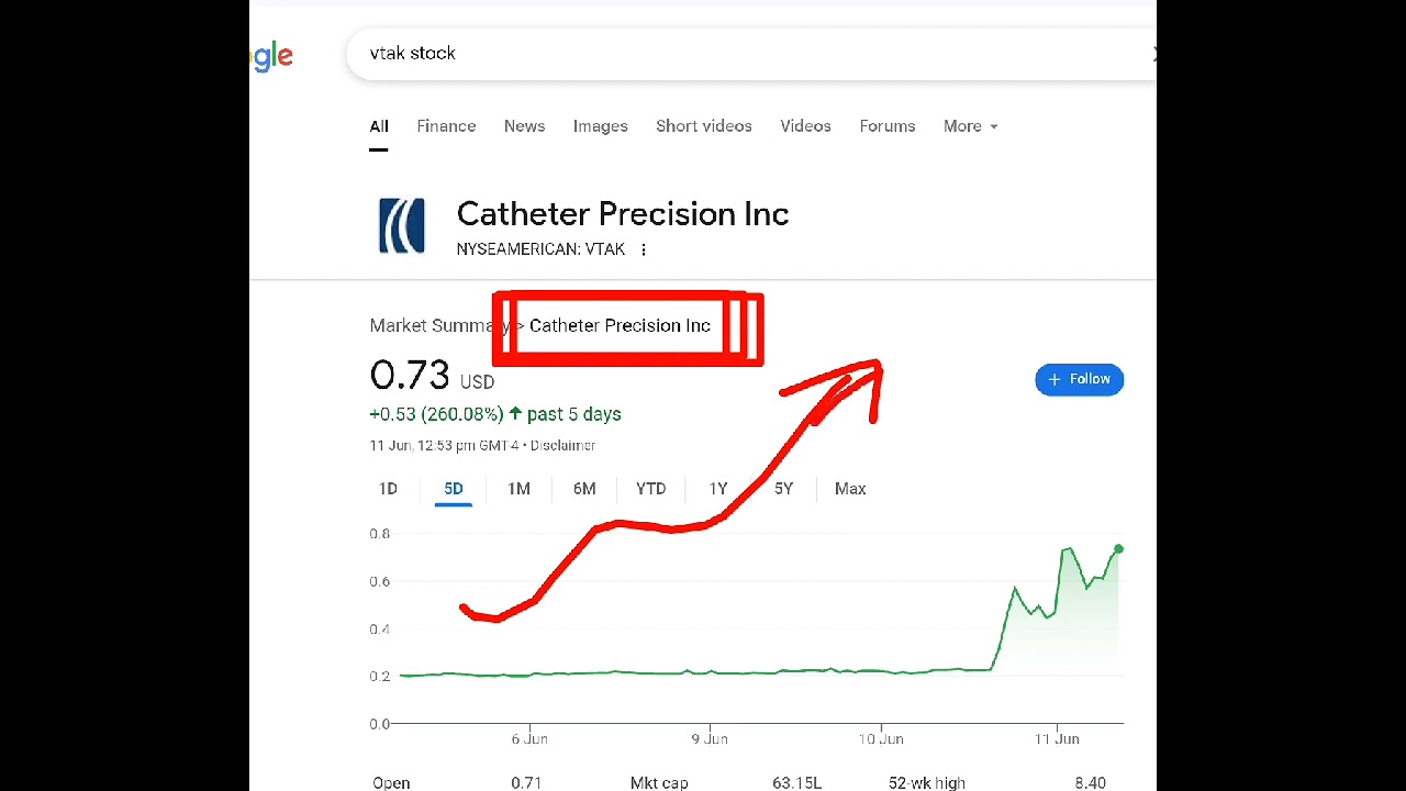 Catheter Precision, vtak stock analysis buy or sell