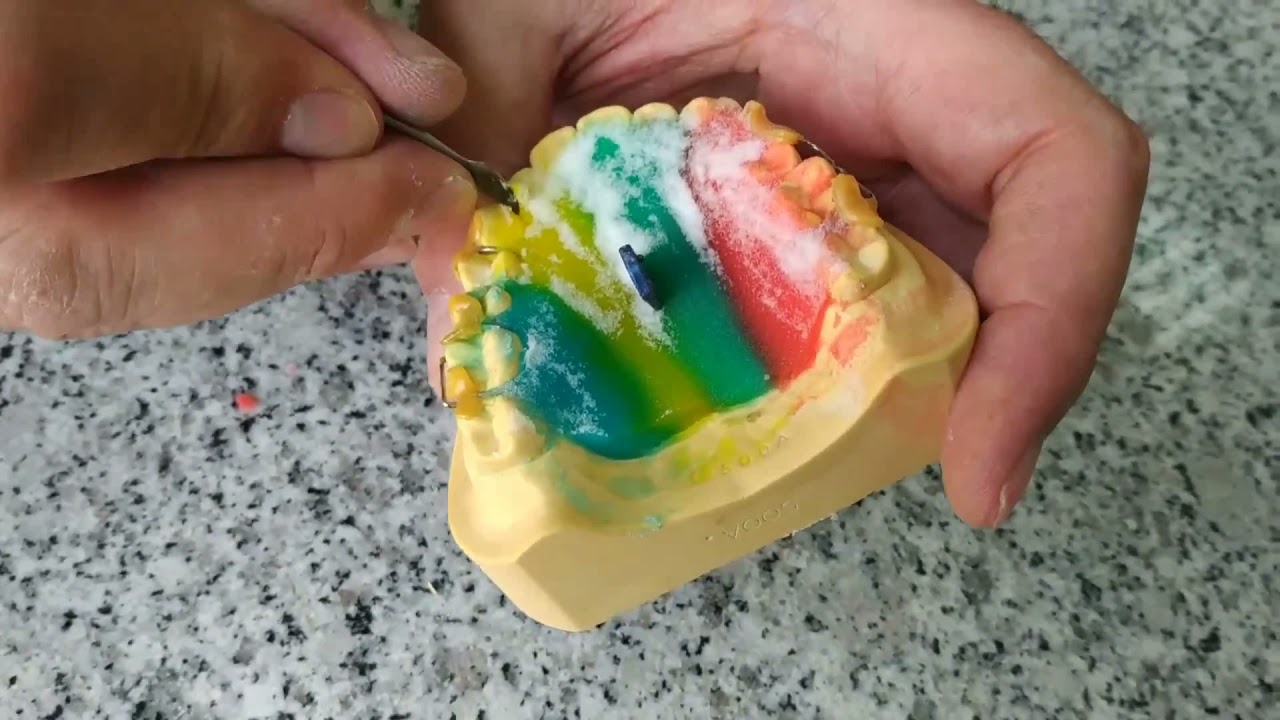 Wujek Popa przedstawia  POLIMERYZACJA I OBRÓBKA APARATU ORTODONTYCZNEGO cykl ortodoncja jest fajna