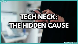 Do Phones Cause Tech Neck?