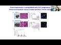 Understanding Phenotypic Plasticity in Hepatocellular Carcinoma to Mitigate Therapy Resistance