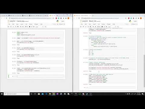 Detecting blood cells with Python package cv2. Episode one