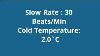 Daphnia Heart Rate Experiment