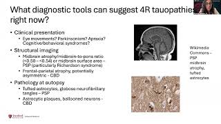 Neuroimaging & BiomarkersNeuroimaging & Biomarkers From Current Practice to Future Tools