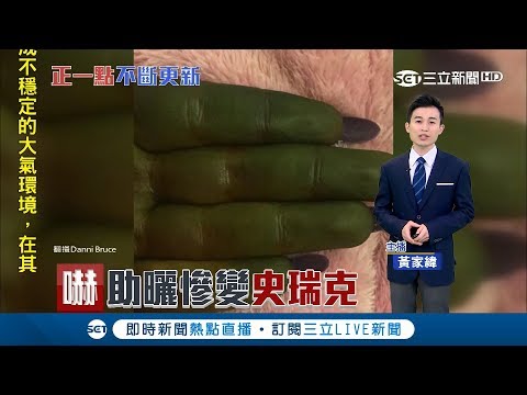 慘!英女助曬不成 反成了女版史瑞克 全身綠油油!不敢出門│主播 黃家緯│【新聞正一點】20180507│三立新聞台