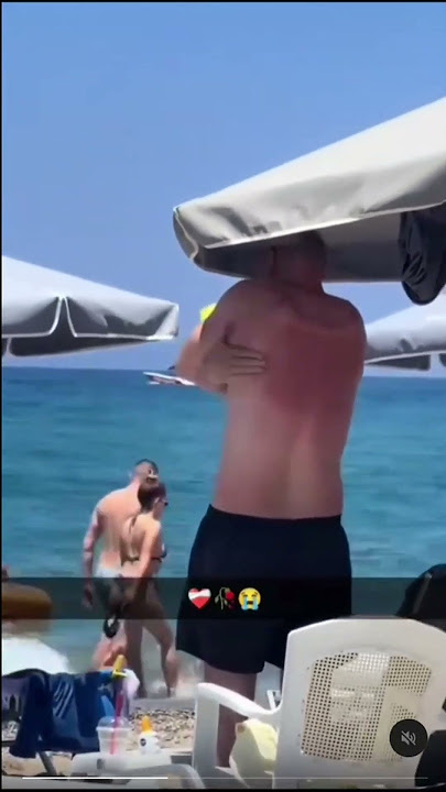 He Missed ONE Spot and Got Branded by the Sun