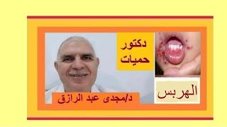 علاج الهربس الفموى والتناسلى معلومات عامة عن الطب  TREATMENT OF ORAL AND GENITAL HERPES SIMPLEX