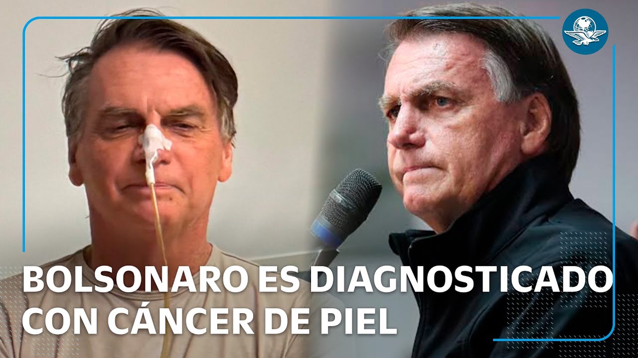 Diagnostican a Jair Bolsonaro con cáncer de piel