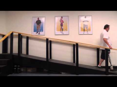 Osseointegration Patient - 11 months post surgery