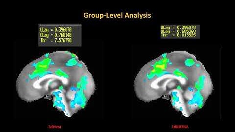 Milwaukee AFNI Workshop, Part 5: 2nd Level Analysis