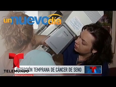 ¡Las mamografías podrían dar falsos casos de cáncer! | Un Nuevo Día | Telemundo