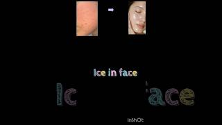 teenager skin care routine ✅|#trending #skincare #shorts |sreyaahhh