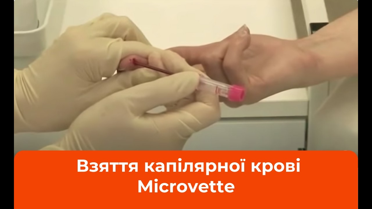 Техніка взяття капілярної крові Microvette