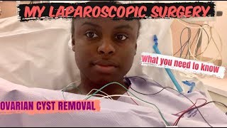 OVARIAN CYST/ LAPAROSCOPIC SURGERY | WHAT YOU NEED TO KNOW Ovarian Cyst Do I Need Surgery