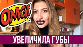 УВЕЛИЧЕНИЕ ГУБ В САРАТОВЕ - МОЙ ОТЗЫВ О ПРОЦЕДУРЕ, ЦЕНА ❤ УВЕЛИЧЕНИЕ ГУБ В САРАТОВЕ - МОЙ ОТЗЫВ О ПРОЦЕДУРЕ, ЦЕНА ❤