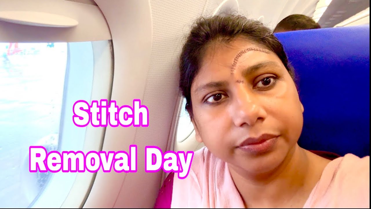 Before & After Surgery Result/ Scar Revision  Surgery Results