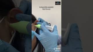 The process of making an ear impression