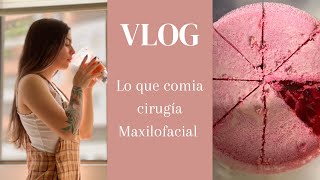 Dieta cirugía maxilofacial (qué comer)