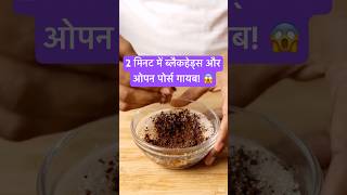 2 मिनट में ब्लैकहेड्स और ओपन पोर्स गायब! 😱 Simple Pores Hacks #shorts #skincare #facts #brightskin
