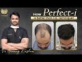 Perfecti technique is better than fue  hair transplant results in india  medlinks